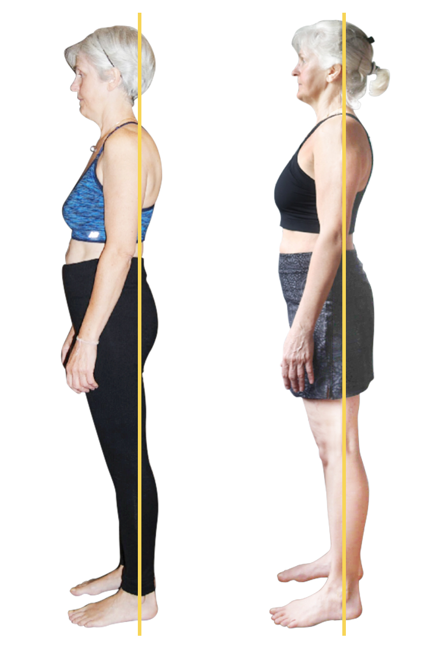 Heal Hernia without Surgery | Breathing for core strength | Fit Align