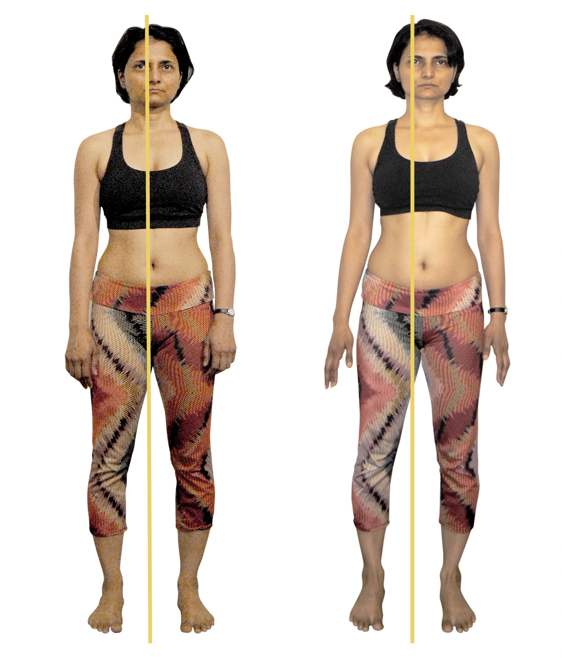 FitAlign® Posture Training